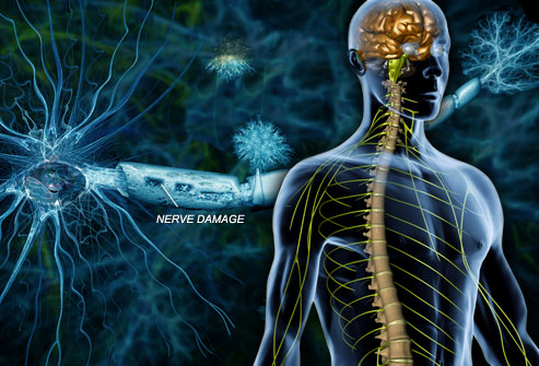 Afecta al sistema nervioso central