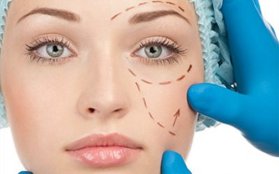 Negligencias médicas en la cirugía estética