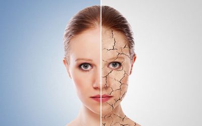 Demandas por productos defectuosos